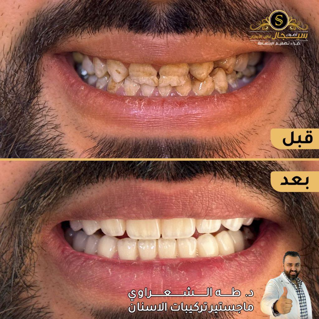 We specialized in providing high quality cosmetic teeth services in a unique way and drawing the  details of your smile which attracts everyone's attention.